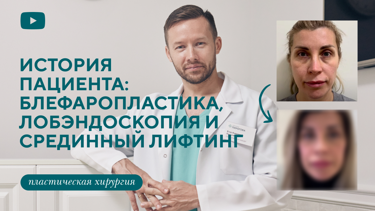 Разбор случая: пациентка после блефаропластики, лобэндоскопии и срединного лифтинга (Парыгин Е.А.)