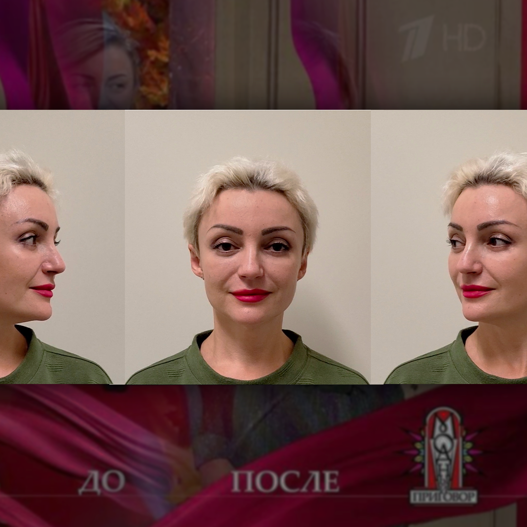 От телешоу до операционной: как преподаватель нашла свою формулу красоты и уверенности!