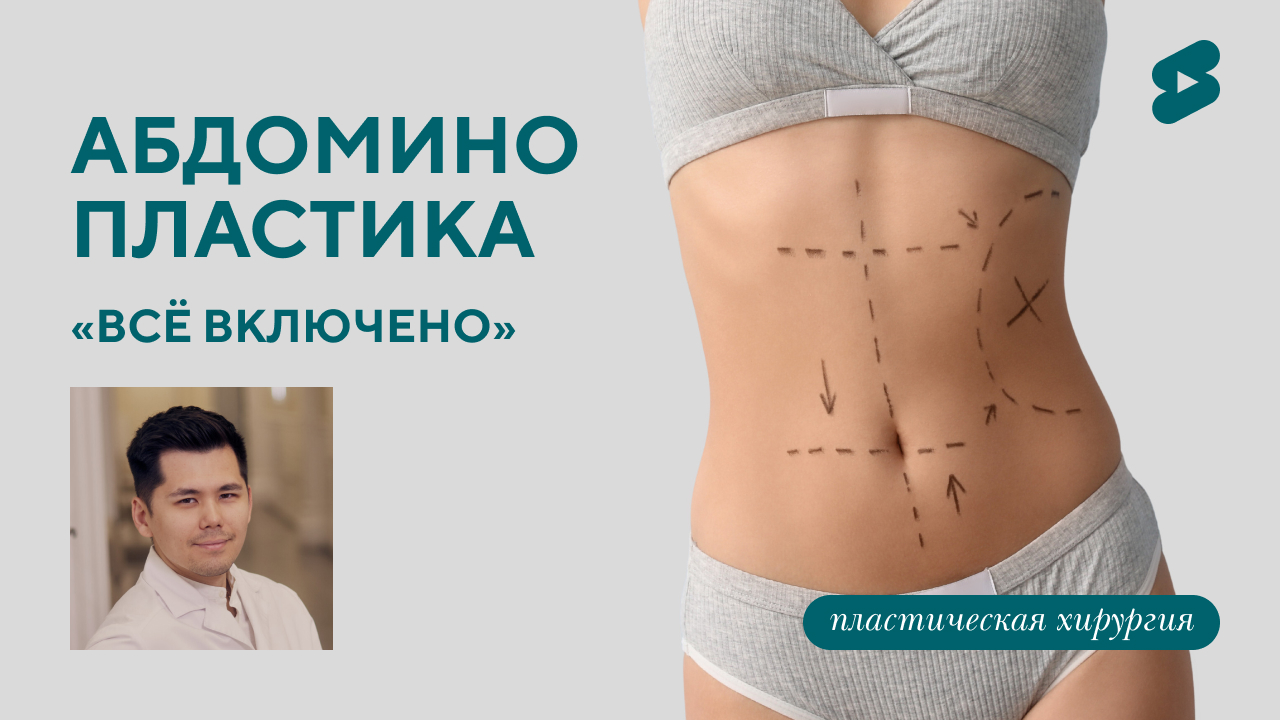 Акция! Абдоминопластика "Всё включено". (Бударин М.С.)