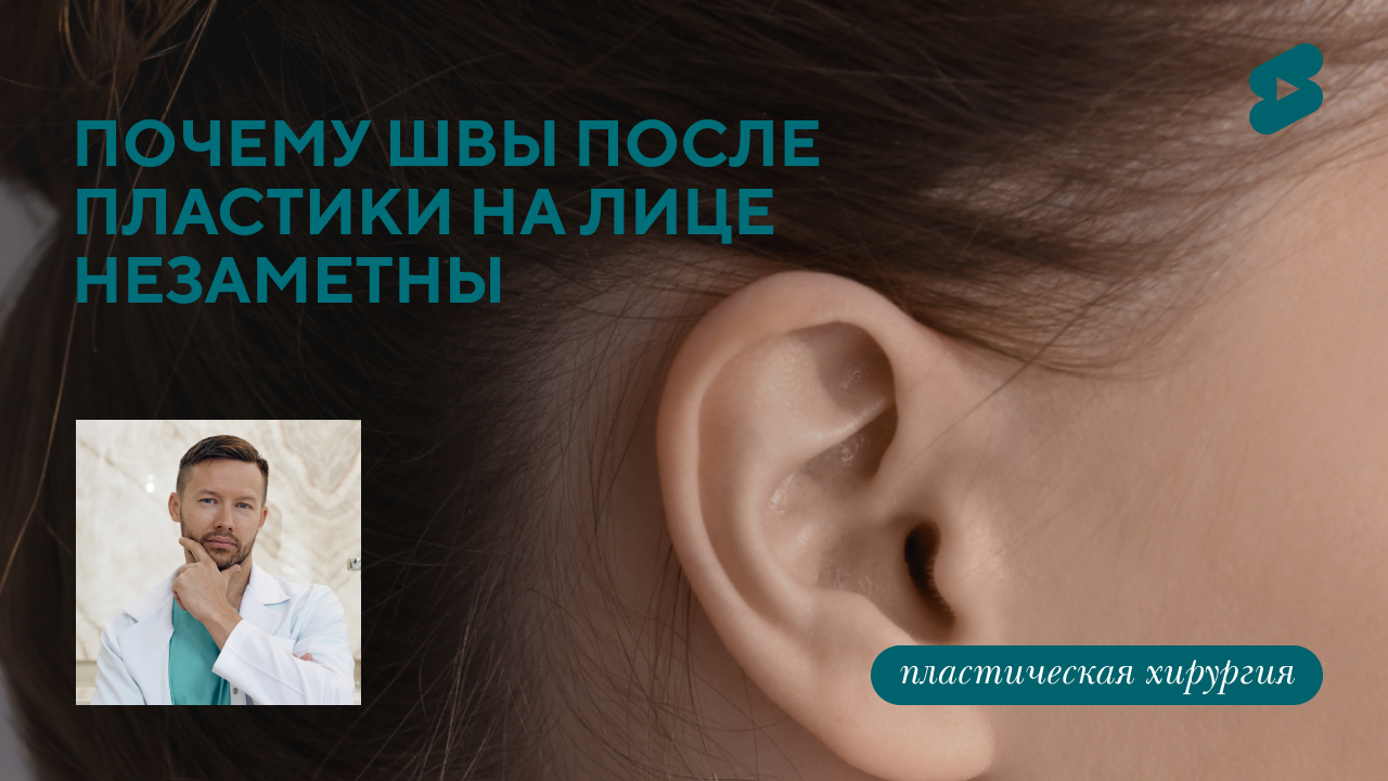 Почему швы после пластики на лице незаметны? (Парыгин Е.А.)