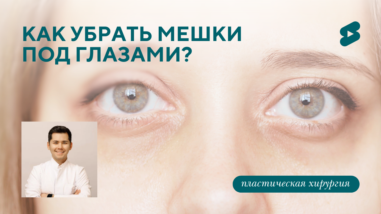 Как убрать мешки под глазами? (Бударин М.С.)