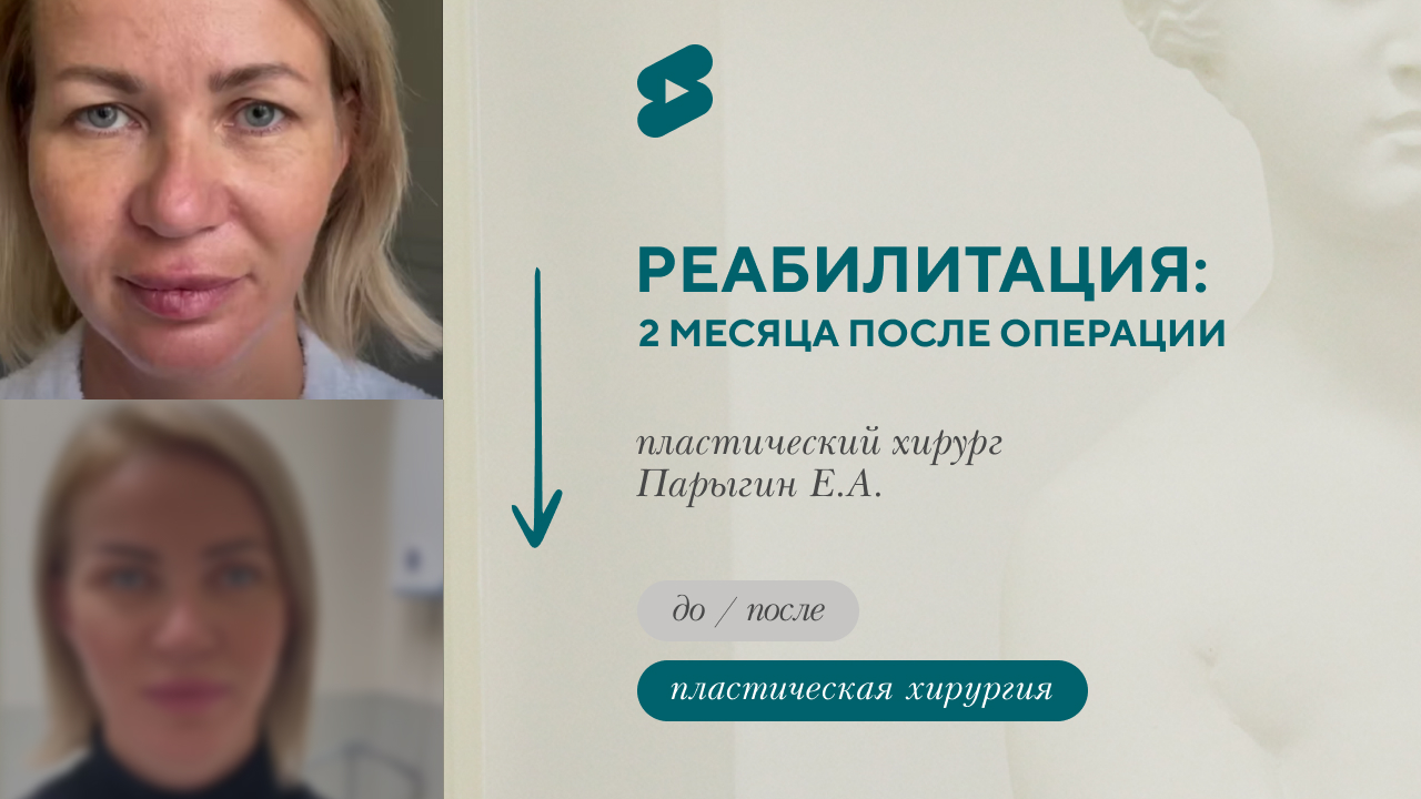 Реабилитация после пластической операции (Парыгин Е.А.)
