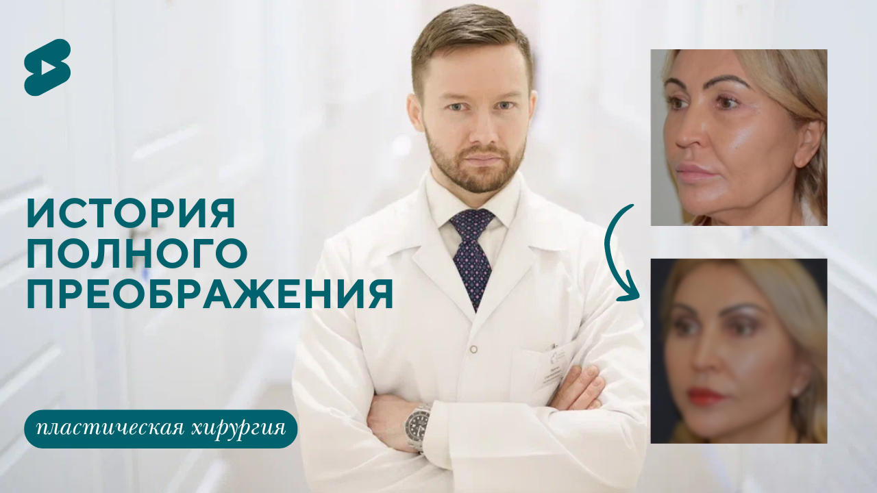 Комплексное омоложение лица: подтяжка овала лица и шеи, блефаропластика и подтяжка лба.  (Парыгин Е.А.)