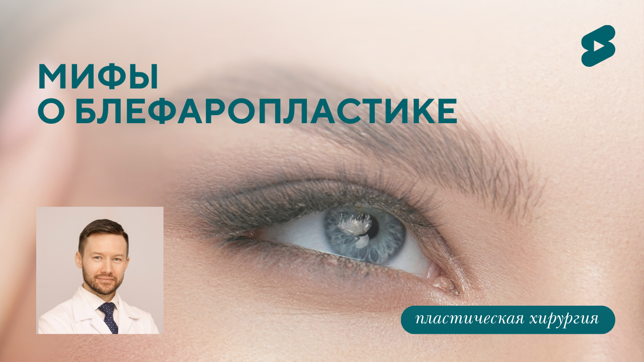 Популярные мифы о блефаропластике.  (Парыгин Е.А.)