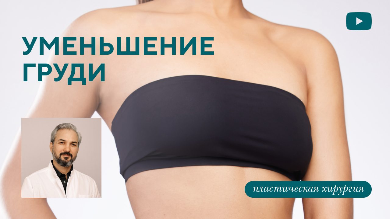 Уменьшение груди (редукционная маммопластика). (Хатри А.Р.)