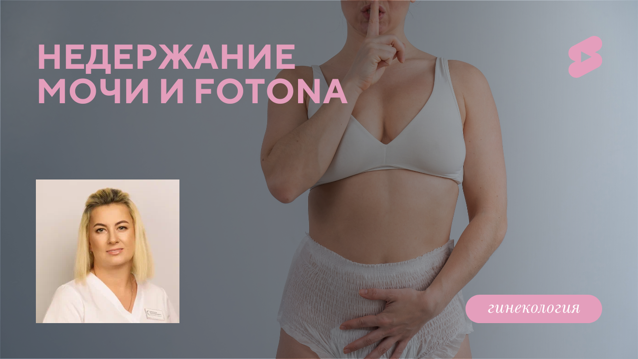 Недержание мочи и Fotona (Цыбулевская Н.Г.)