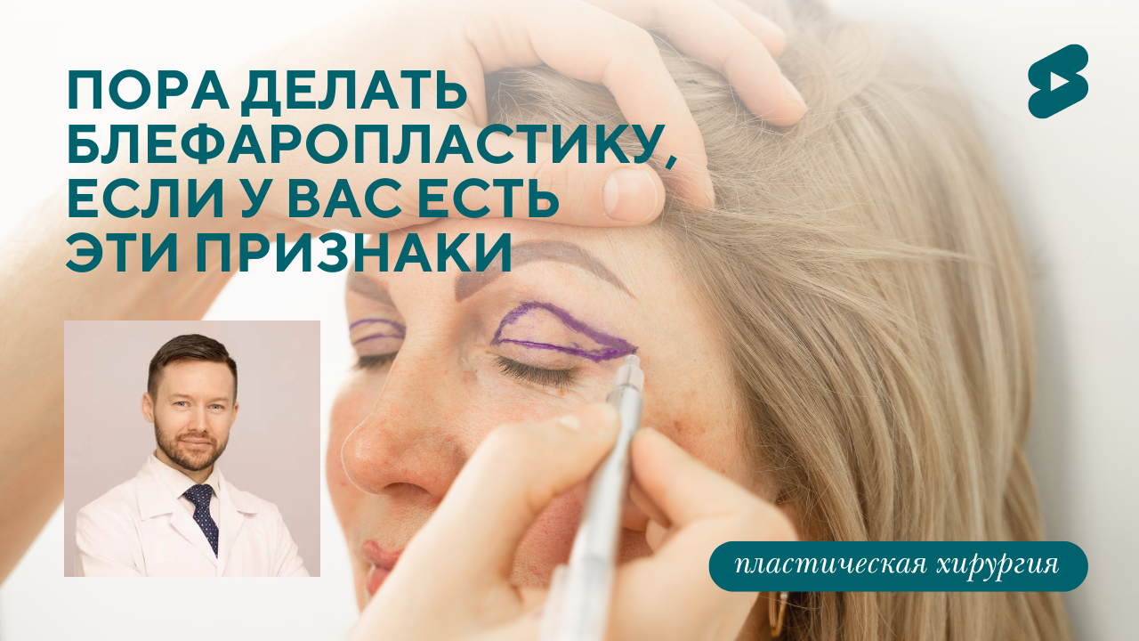 Пора делать блефаропластику, если у вас есть эти признаки. До, после (Парыгин Е.А.)