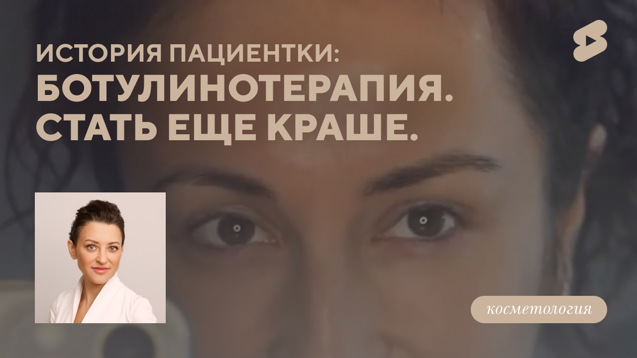 История пациентки:  ботулинотерапия. стать еще краше. (Белова О.М.)