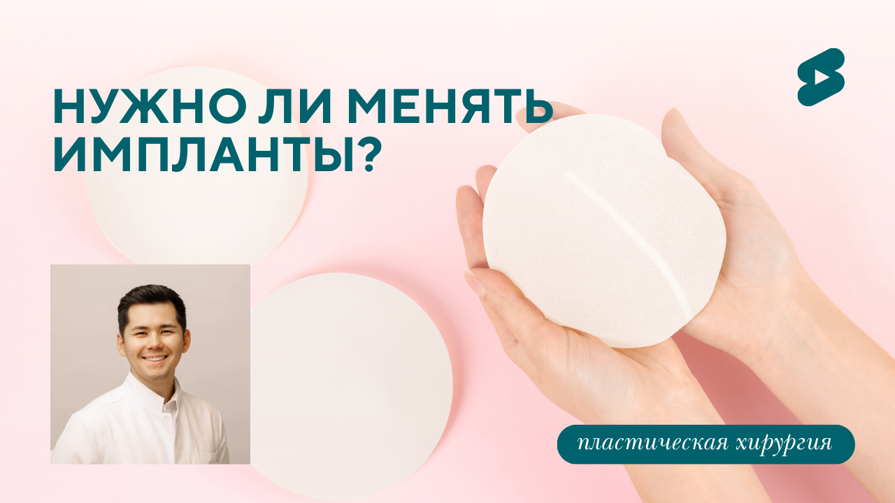 Нужно ли менять импланты? (Бударин М.С.)