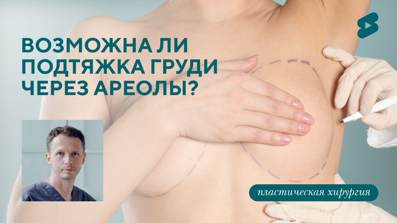 Возможна ли подтяжка груди через ареолы? (Барсаков М.А.)
