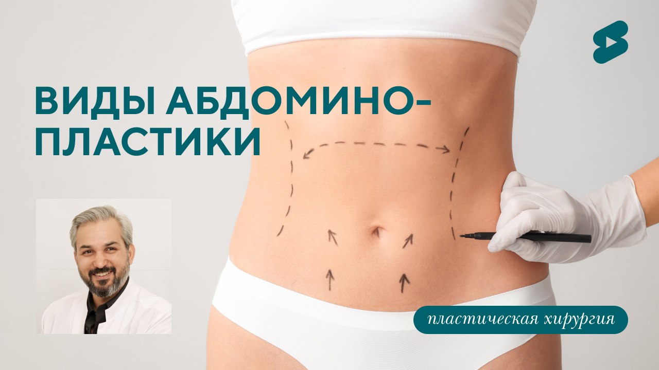 Виды абдоминопластики. Как похудеть за несколько часов? (Хатри А.Р.)