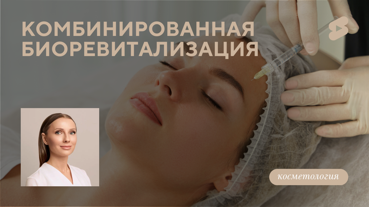 Что такое комбинированная биоревитализация? (Бентелева К.А.)