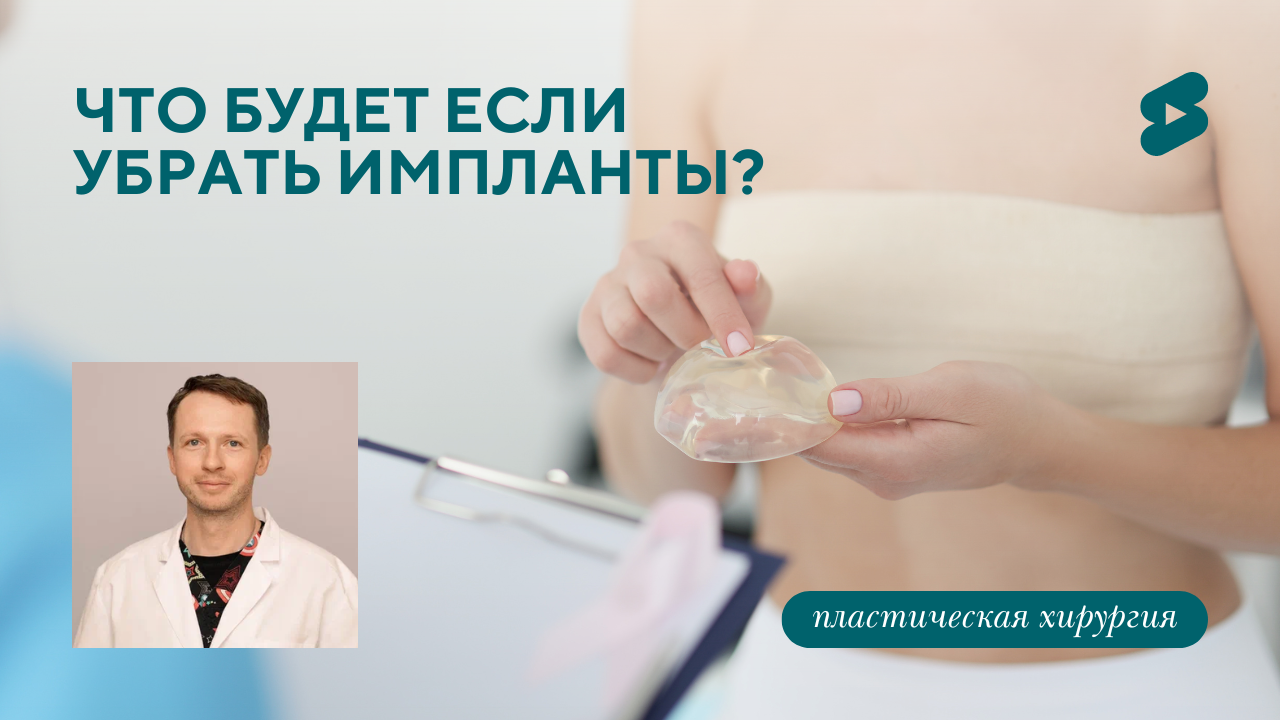 Что будет если убрать импланты? (Барсаков М.А.)