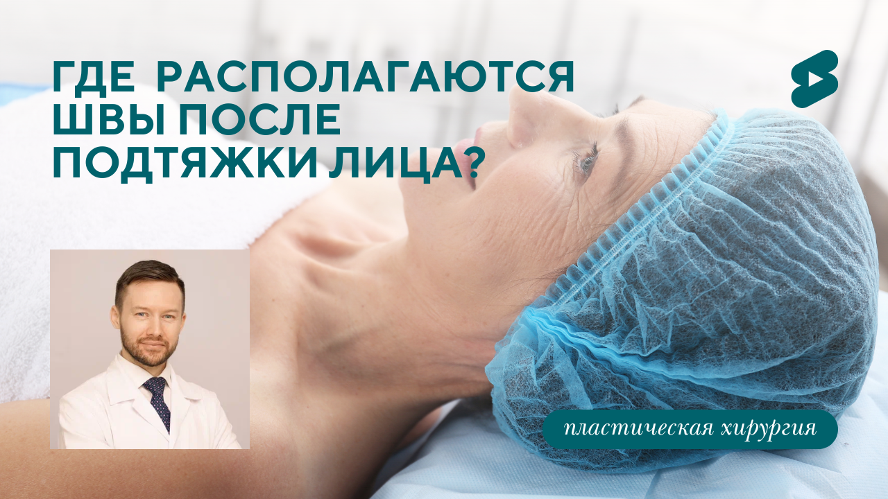 Как выглядит пациент после фейслифта, платизмопластики и эндоскопической подтяжки лба? Осмотр пациента (Парыгин Е.А.)