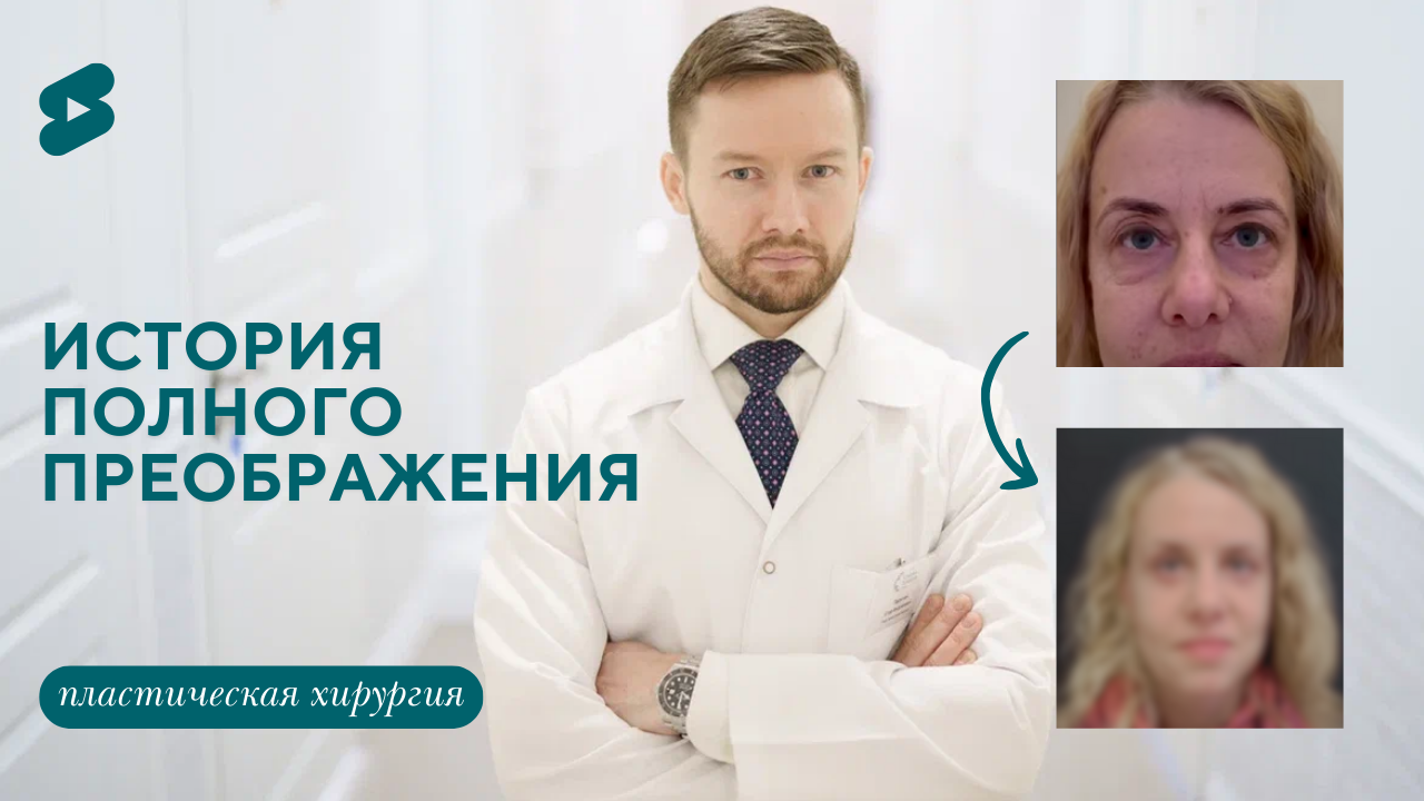 История пациента: до и после пластической операции (Парыгин Е.А.)