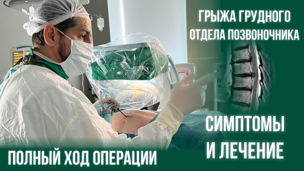 Лечение грыжи уфа