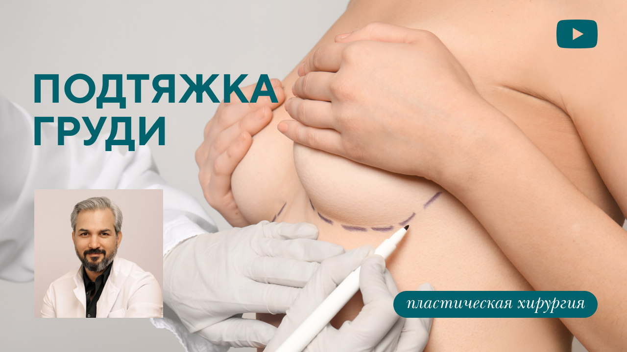 Подтяжка груди (маммопексия или мастопексия). (Хатри А.Р.)