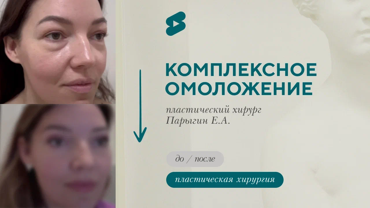 Мой опыт пластической операции: отзыв пациентки (Парыгин Е.А.)
