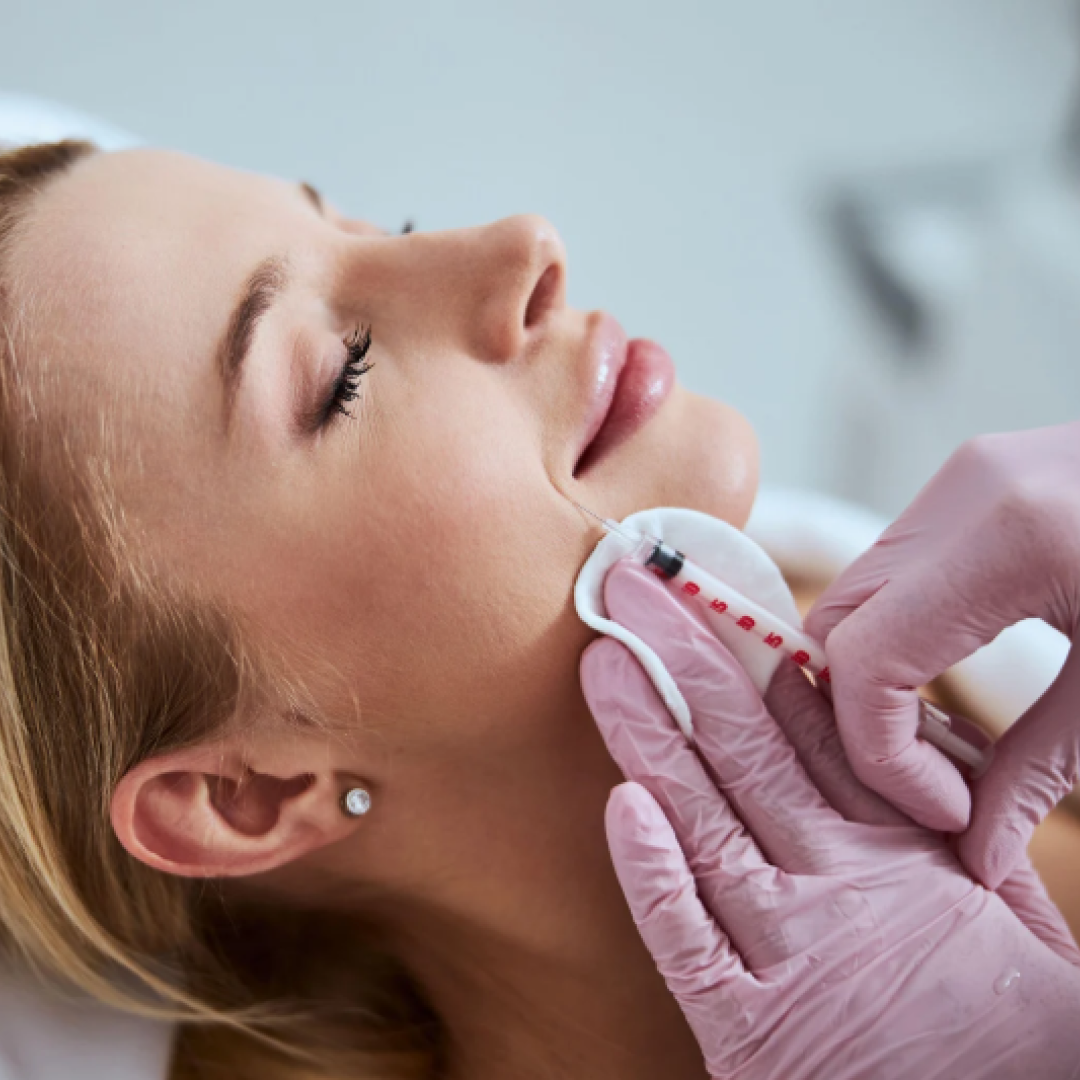 Контурная пластика носогубных складок