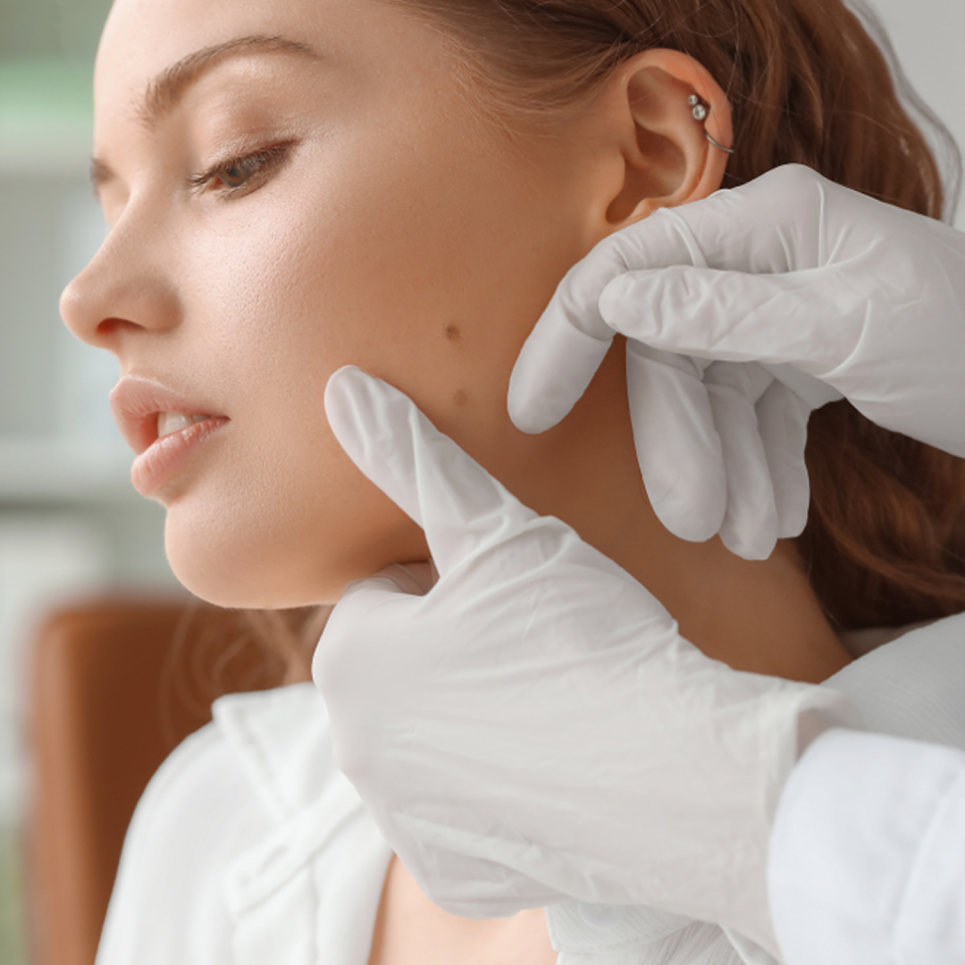 Новообразования: удалить нельзя оставить